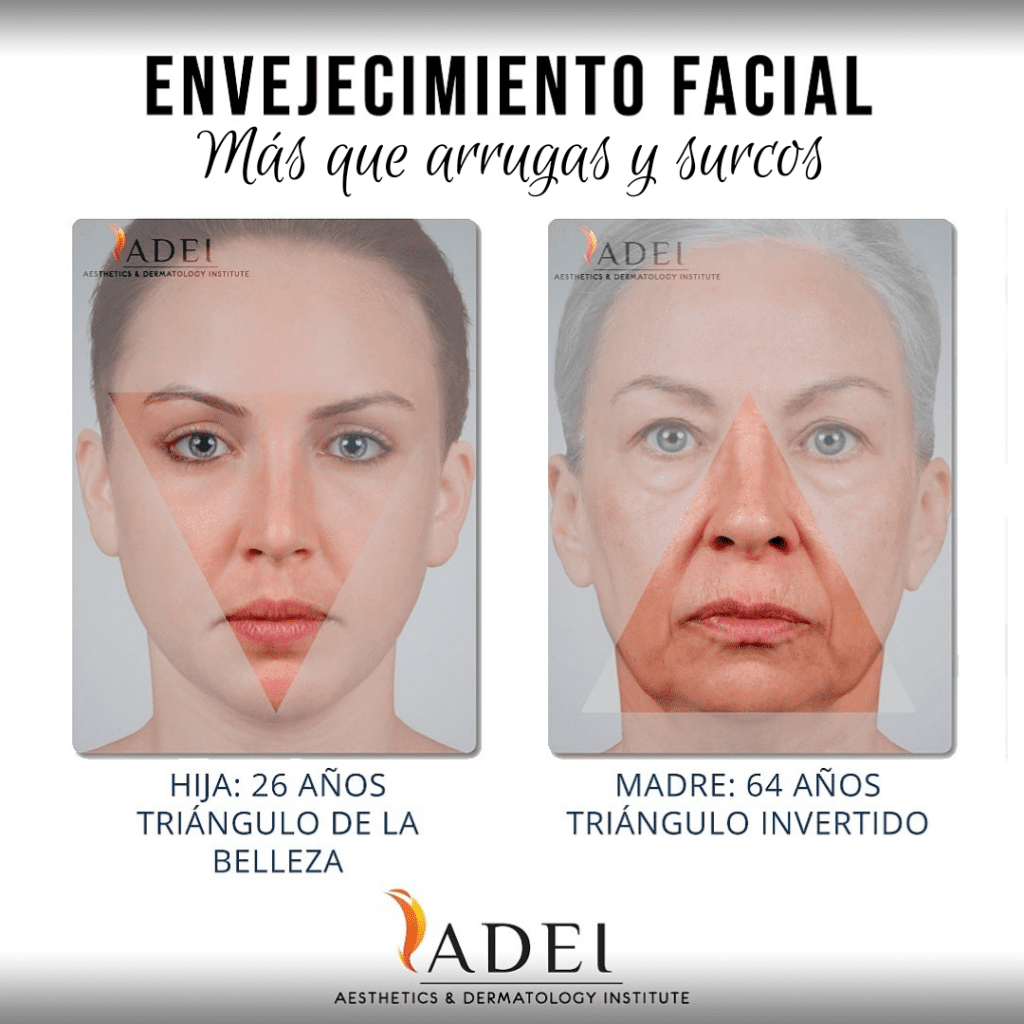 Triángulo de la Belleza ADEI
