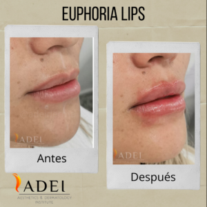 Euphoria Lips
